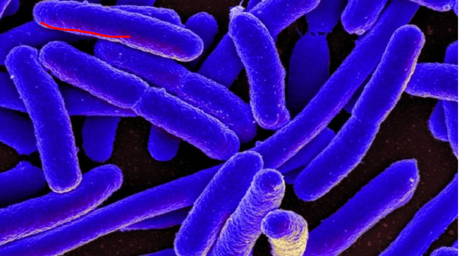 Vi khuẩn E.Coli không 'lành' như bạn vẫn nghĩ và 5 chìa khóa phòng ngộ độc thực phẩm