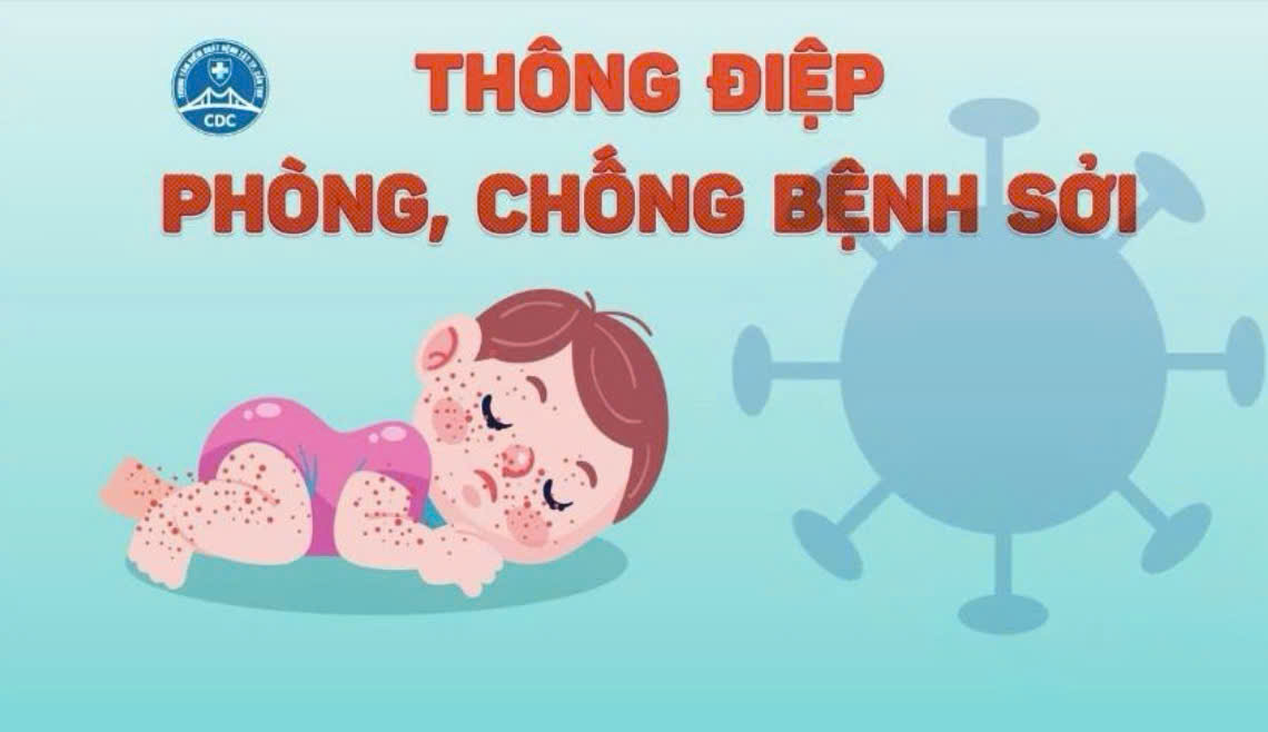 UBND Quận Ba Đình: Bộ Y tế đưa ra 10 thông điệp phòng chống bệnh sởi hiệu quả